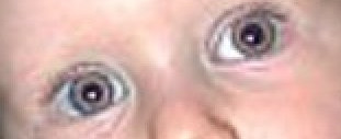 Anwendungsbeispiel für das Filter »Rote Augen entfernen«
