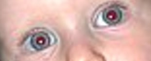 Anwendungsbeispiel für das Filter »Rote Augen entfernen«